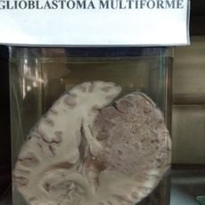 Museo del Cerebro